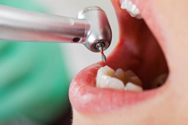 Emergency Dentist for Kids in GA